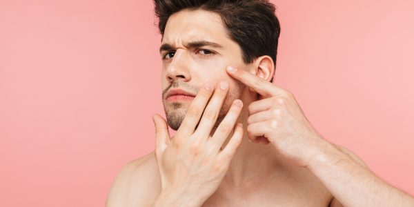 Debunking the Myth: Does Masturbation cause Acne?
